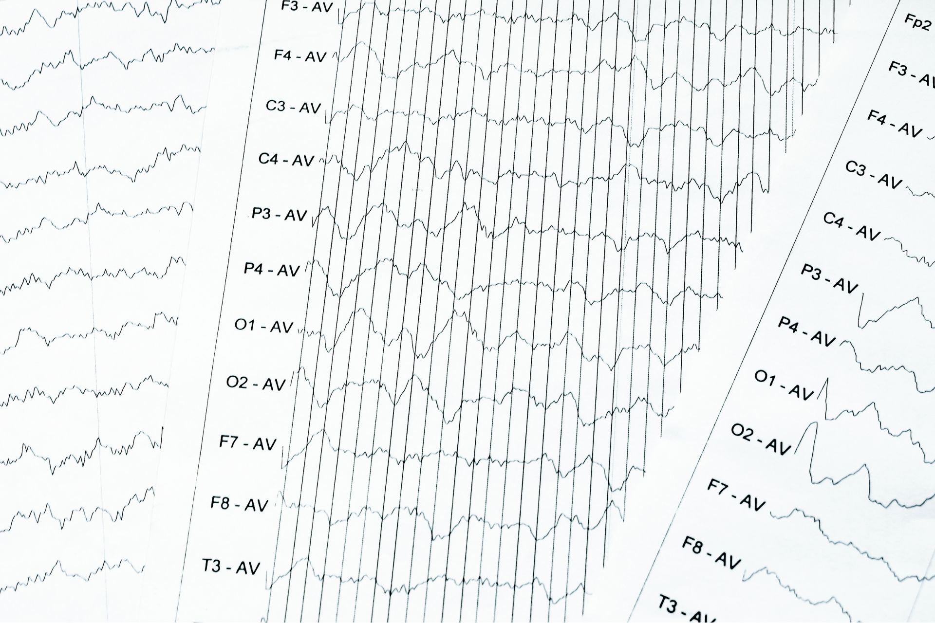 Discover the Science Behind qEEG Brain Mapping and Brain Function